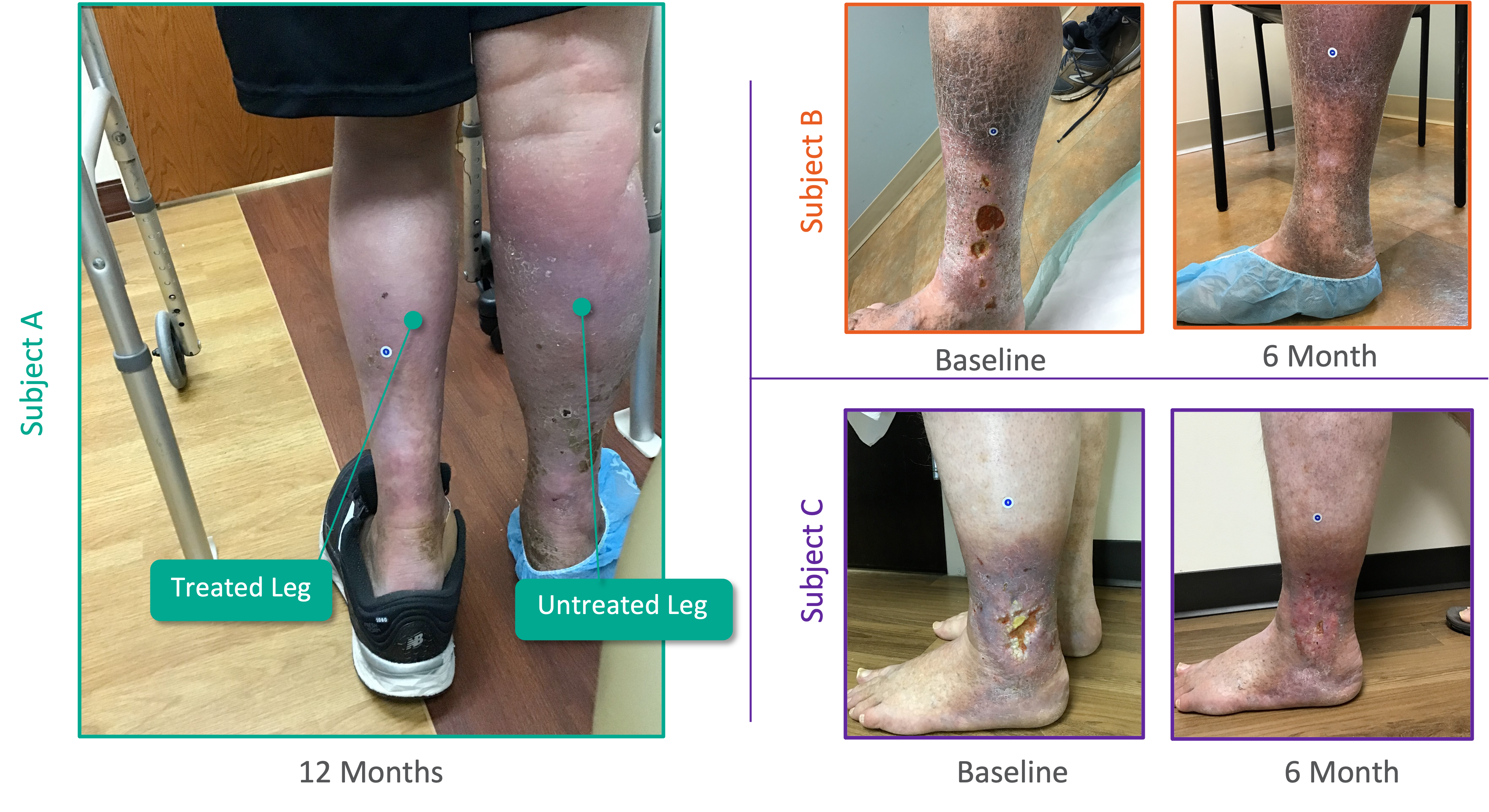 Chronic Venous Insufficiency (CVI), Department of Surgery